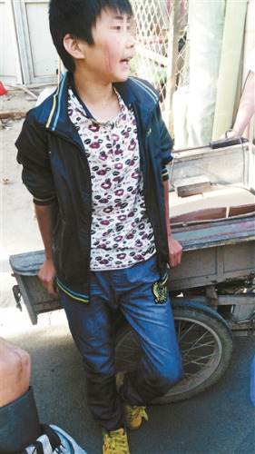 被打者小高 摄影  杨琳 被打者小高 摄影  杨琳