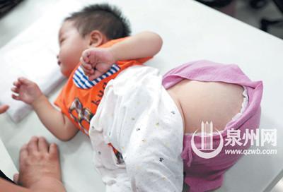 肉瘤已长到足球般大 肉瘤已长到足球般大