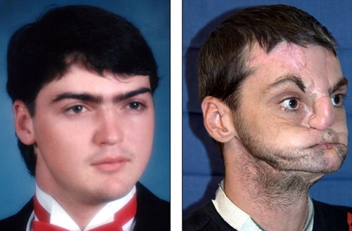 换脸前的照片(受伤前后) 换脸前的照片(受伤前后)