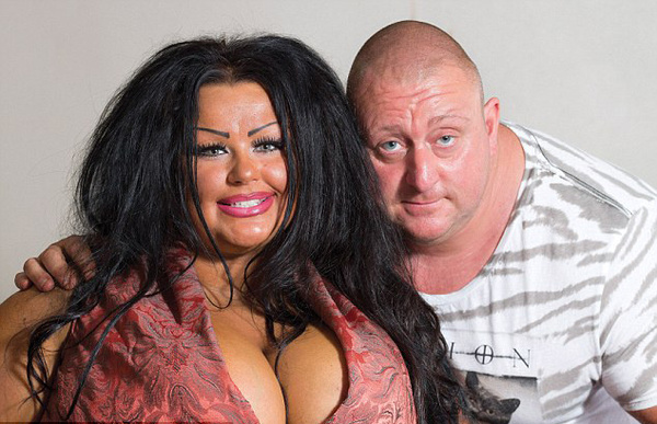 她做过的手术包括5次隆胸术、唇部注射、肉毒杆菌注射、牙齿美白、和半永久性妆容等。