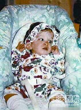 不老女婴 不老女婴