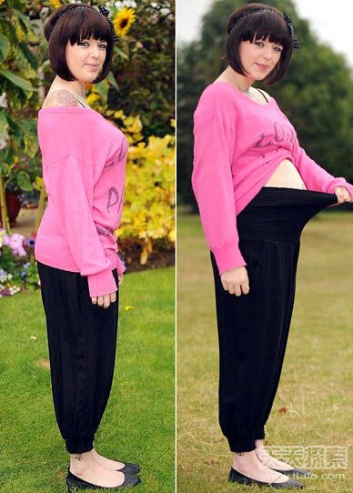 英女子患怪病 一进食肚皮就如气球似怀孕 英女子患怪病 一进食肚皮就如气球似怀孕