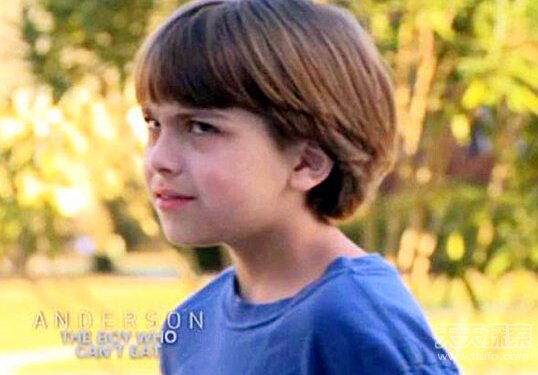 美国一9岁男孩患怪病 吃闻食物可能导致死亡 美国一9岁男孩患怪病 吃闻食物可能导致死亡