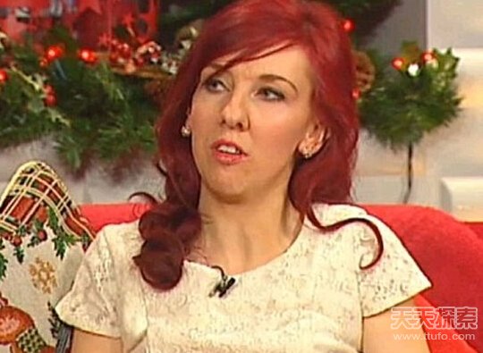 爱尔兰25岁女子患怪病 未经历发育期无需戴胸罩 爱尔兰25岁女子患怪病 未经历发育期无需戴胸罩