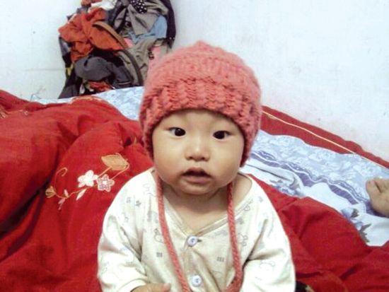 宝宝烫伤前的照片 宝宝烫伤前的照片