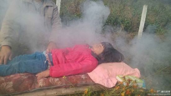 火熏治疗6 火熏治疗6