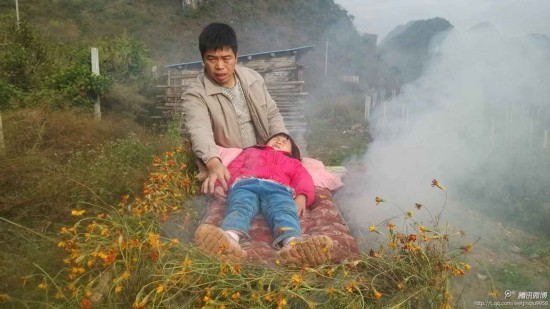 火熏治疗7 火熏治疗7