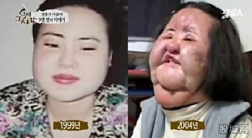 电风扇大妈整容失败后样子极其恐怖 电风扇大妈整容失败后样子极其恐怖