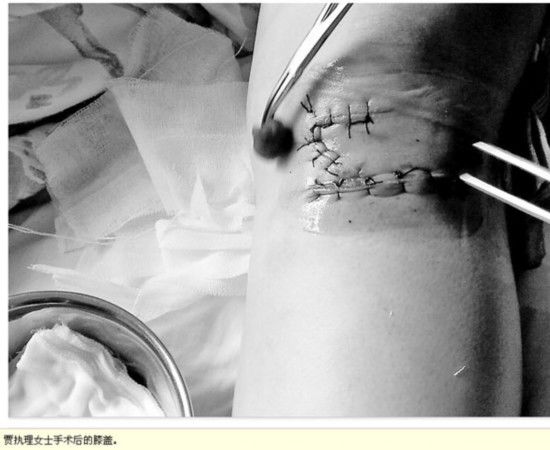 山西芮城“夫妻局长”养3条藏獒咬伤8人 山西芮城“夫妻局长”养3条藏獒咬伤8人