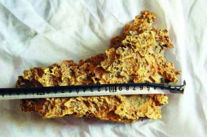 新疆牧民捡到8公斤狗头金 新疆牧民捡到8公斤狗头金