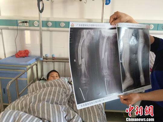 6377841461857494468 6377841461857494468