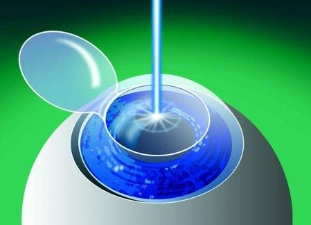 201503312049154788d 201503312049154788d