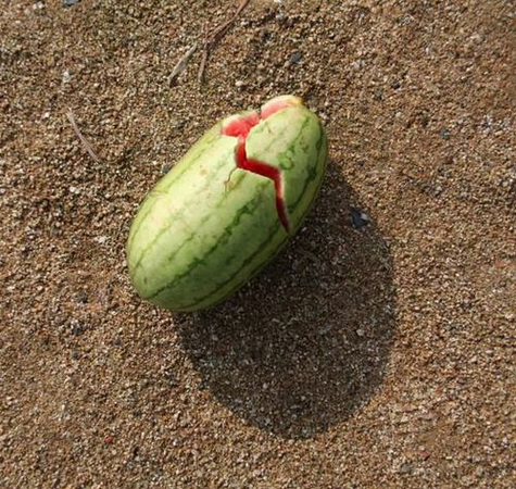 青岛12人吃西瓜中毒-毒素侵入到未出生婴儿的血液中2 青岛12人吃西瓜中毒-毒素侵入到未出生婴儿的血液中2