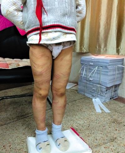 W020150405190913810810 W020150405190913810810