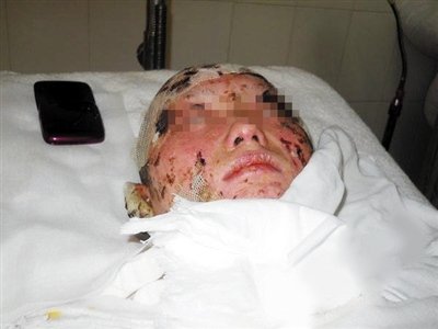 W020150515385878623758 W020150515385878623758