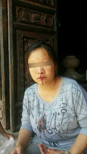 被打的产妇陆某。