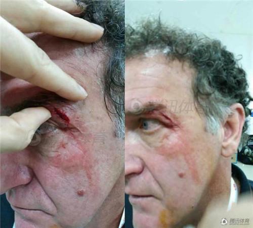 W020150617555766074430 W020150617555766074430