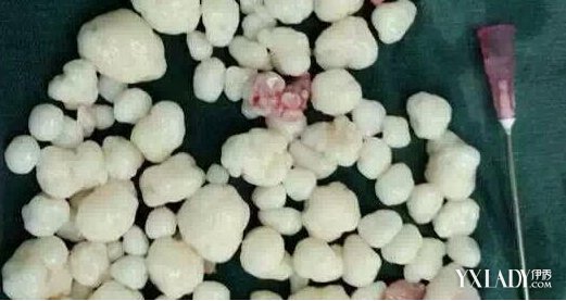 2015070114580564 2015070114580564