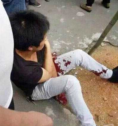 湖南银行门口枪击事件-一押款员开枪打伤青年3 湖南银行门口枪击事件-一押款员开枪打伤青年3