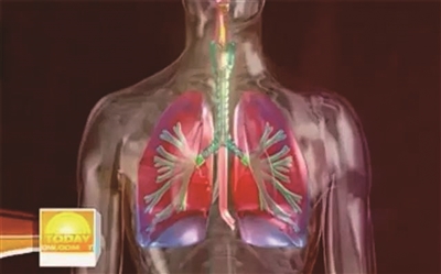 18121038314885945729 18121038314885945729