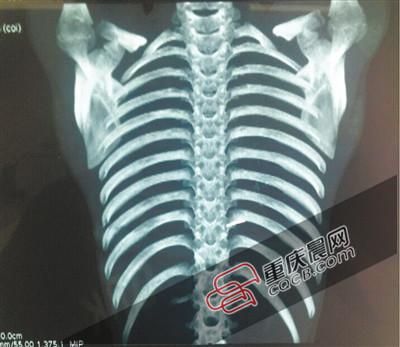 U11489P434T20D174232F1037DT20150714105425 U11489P434T20D174232F1037DT20150714105425