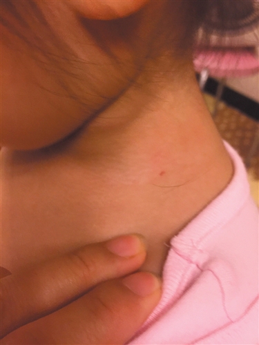 lid57440_b lid57440_b