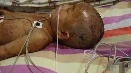 W020150721613028689424 W020150721613028689424