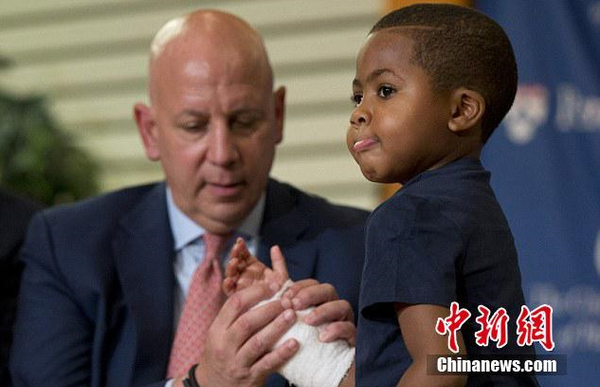 美国8岁男孩成功移植双手-为年龄最小案例4 美国8岁男孩成功移植双手-为年龄最小案例4