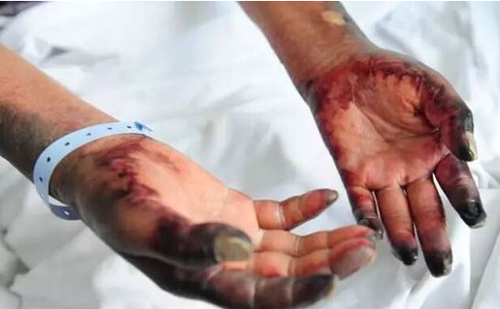 2015080512001101682 2015080512001101682