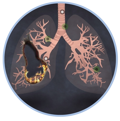 128114405_14392487965071n 128114405_14392487965071n