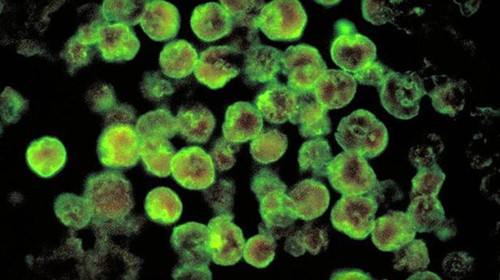 14岁田径新星游泳感染“食脑虫”不治身亡 14岁田径新星游泳感染“食脑虫”不治身亡