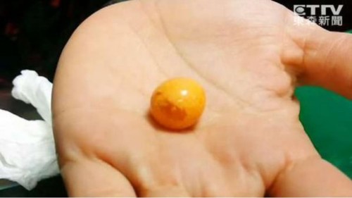 椰子螺吐出美乐珠，图为老板娘捡到的美乐珠