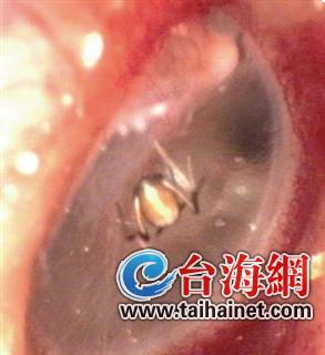 1116706663_14434905326531n 1116706663_14434905326531n