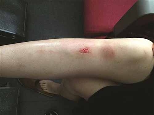 女子掉进站台缝隙膝盖擦伤 名牌女鞋不见了 女子掉进站台缝隙膝盖擦伤 名牌女鞋不见了