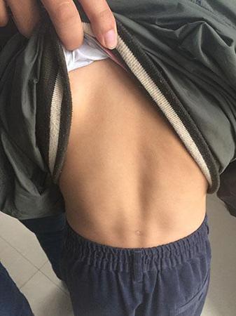 南京虐童 南京虐童