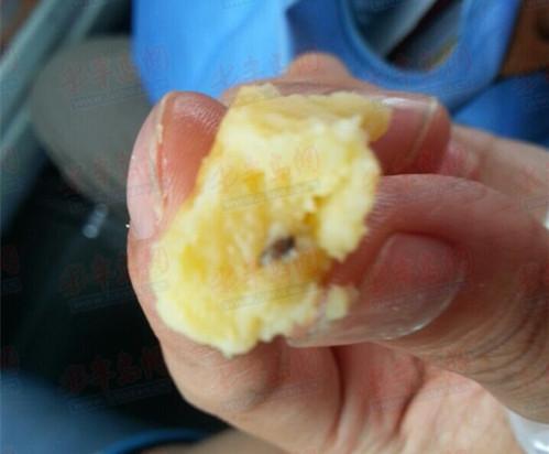 顾客吃糕点硌碎牙 为安装假牙多次手术半边脸红肿只吃流食 顾客吃糕点硌碎牙 为安装假牙多次手术半边脸红肿只吃流食