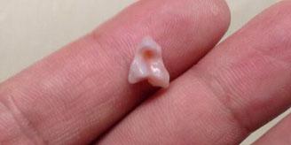 顾客吃糕点硌碎牙 顾客吃糕点硌碎牙