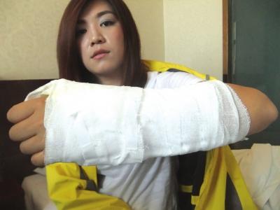 女子在酒店摔倒瓷片戳穿手掌 一方索赔一方否认有责 女子在酒店摔倒瓷片戳穿手掌 一方索赔一方否认有责