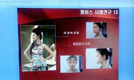 刘亦菲韩国整形证据被曝光 刘亦菲韩国整形证据被曝光