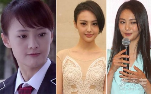 2014年郑爽隆鼻前后对比照：