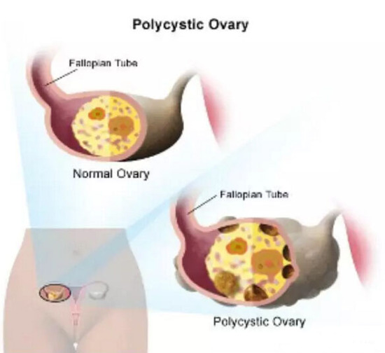 2015110916531988ba6_550 2015110916531988ba6_550