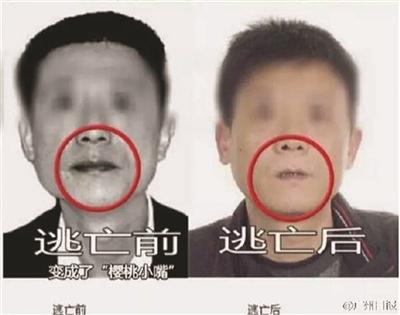 逃犯吃槟榔嘴变小逃亡13年 专家:癌前状态(图) 逃犯吃槟榔嘴变小逃亡13年 专家:癌前状态(图)