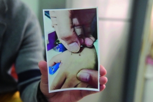 男童因在幼儿园不听话遭老师用订书针扎 男童因在幼儿园不听话遭老师用订书针扎