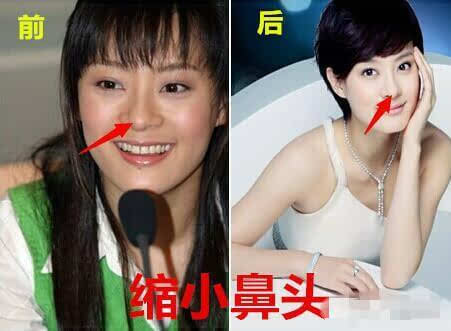 孙俪被导演赞用生命演戏，这次孙俪自曝整过容，这算不算也是用生命在演戏？1