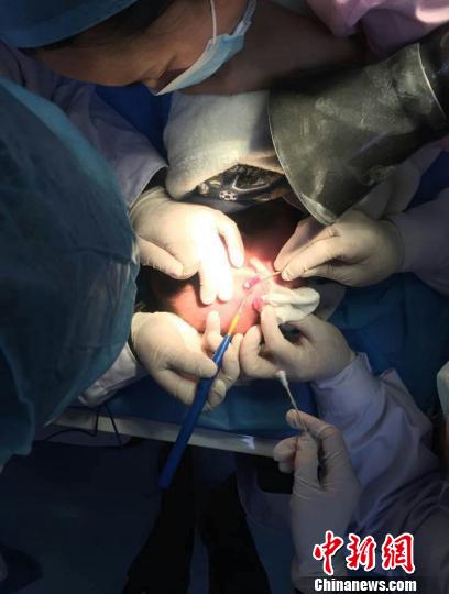 四川“兽皮痣”小男孩病情引关注北京专家抵蓉会诊