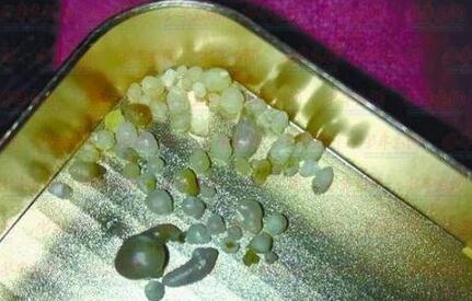 买生蚝吃出珍珠