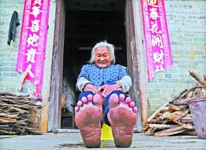 年近八旬老妇从不穿鞋 上山拾柴如履平地1 年近八旬老妇从不穿鞋 上山拾柴如履平地1