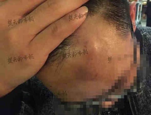 服务员酒瓶砸顾客