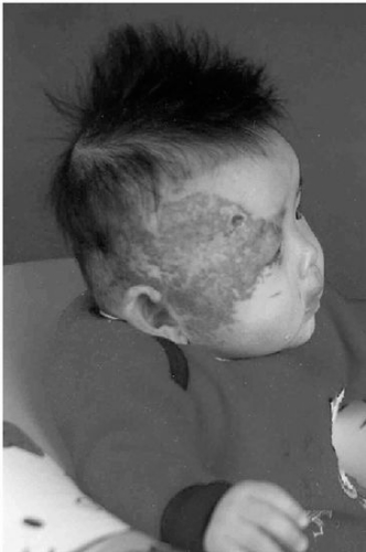 加拿大养母越洋求助 为中国弃婴万里寻亲妈2 加拿大养母越洋求助 为中国弃婴万里寻亲妈2