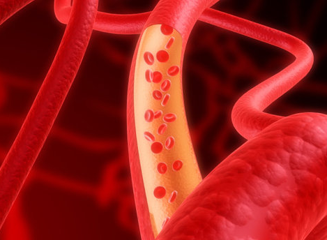 我们贫血补铁需要注意哪10点?